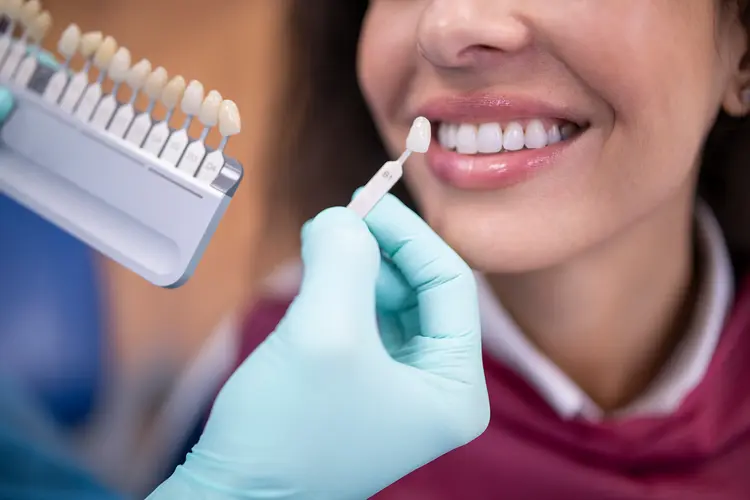 dental implants 