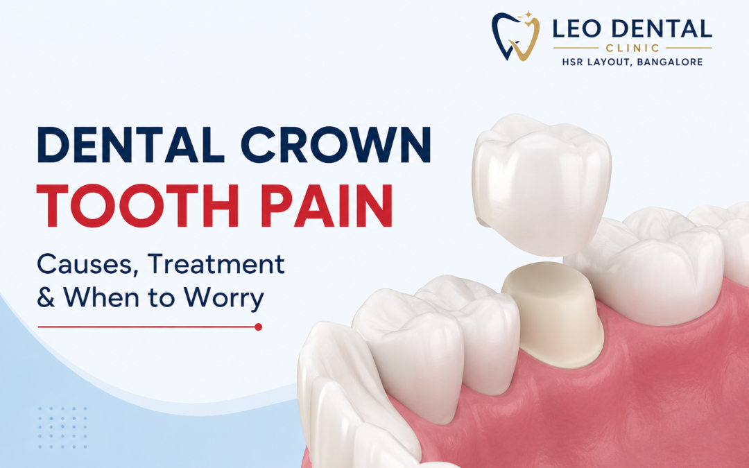 Dental Crown Tooth Pain: Causes, Treatment & When to Worry