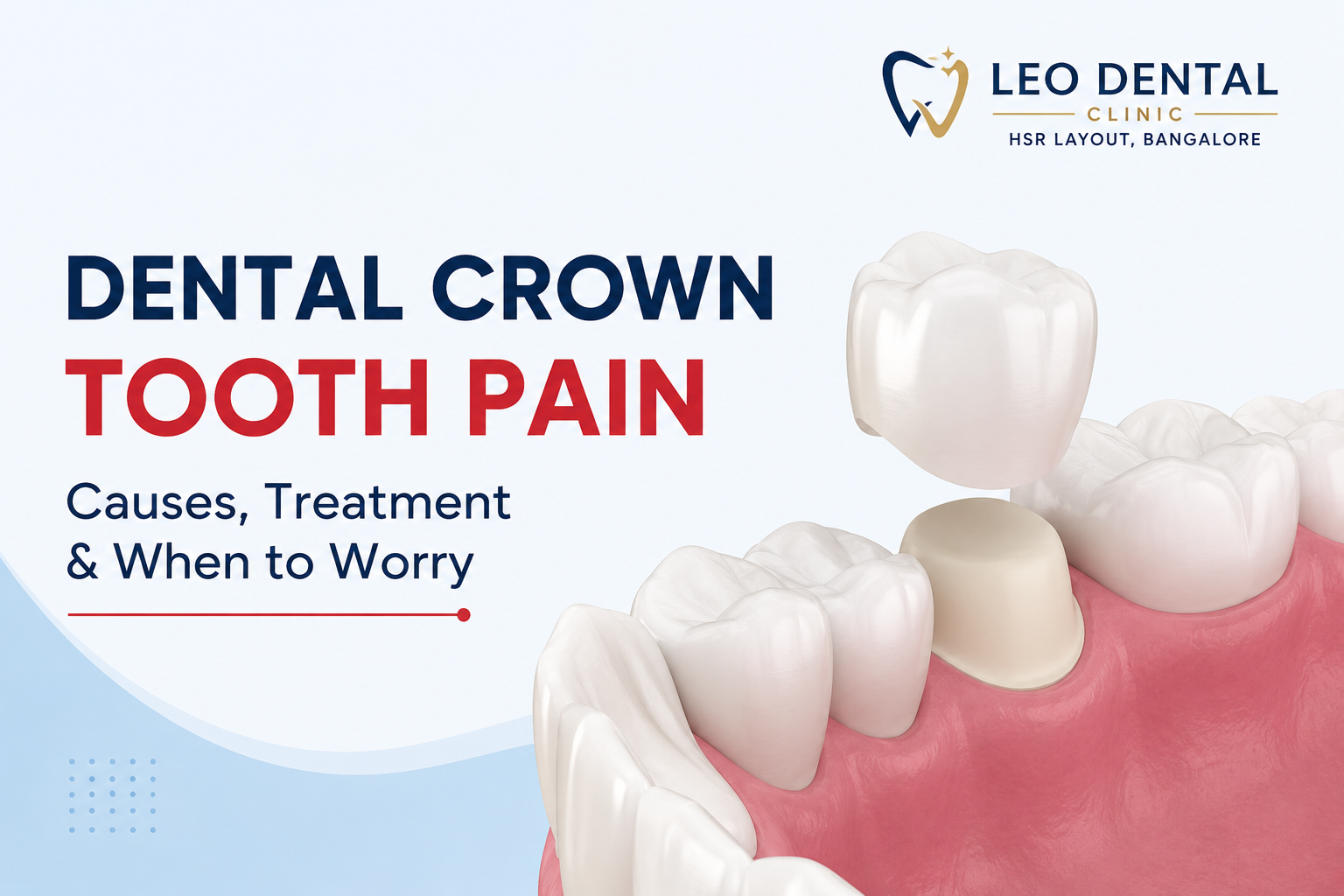 Common Causes of Dental Crown Tooth Pain