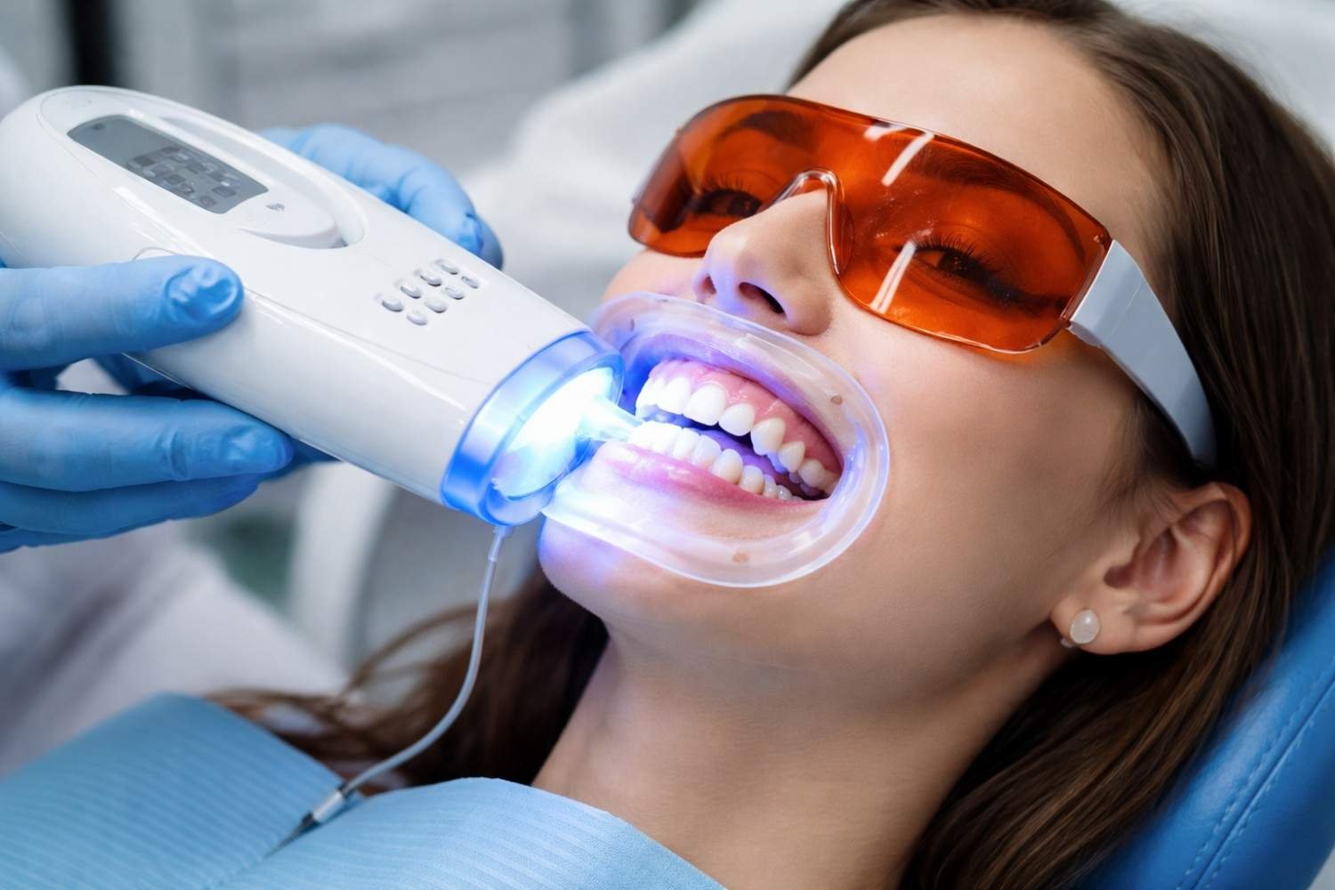 dental implants 