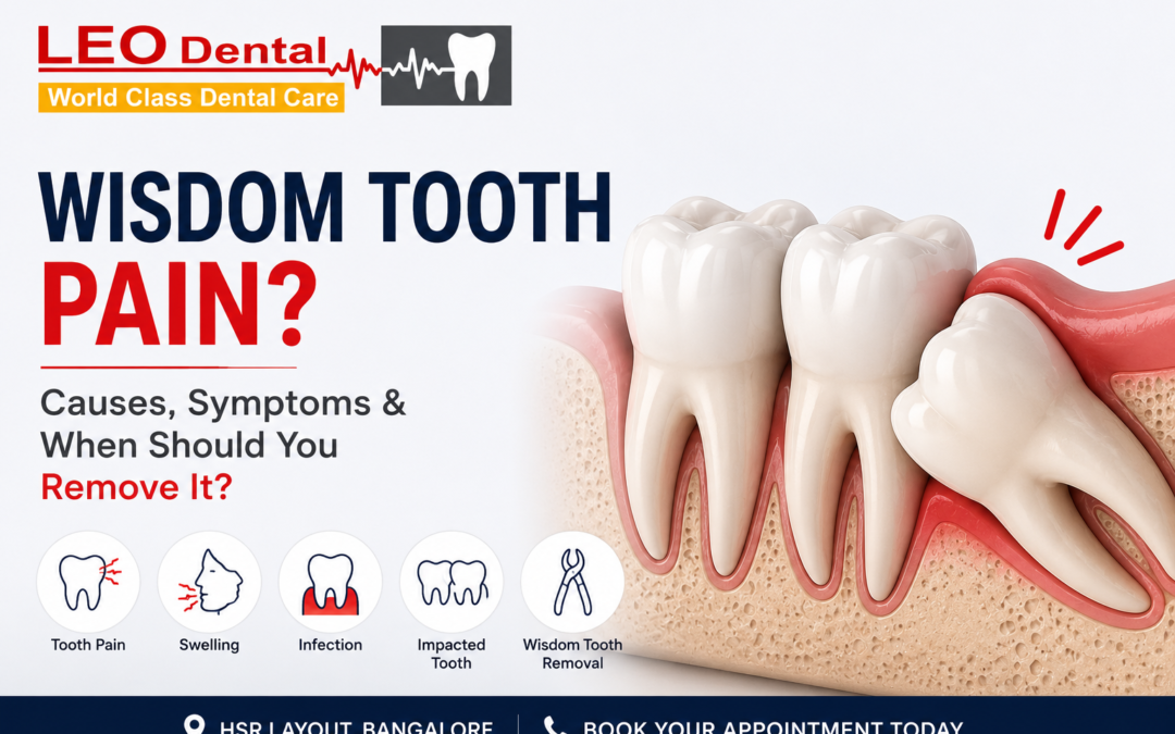 Wisdom Tooth Pain: Causes, Symptoms & When Should You Remove It?