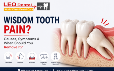 Wisdom Tooth Pain: Causes, Symptoms & When Should You Remove It?